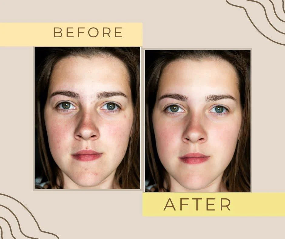 Zafrani Beauty Cream – Natural Glow and Fairness Korean Formula